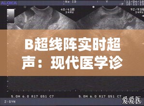 B超线阵实时超声：现代医学诊断的利器