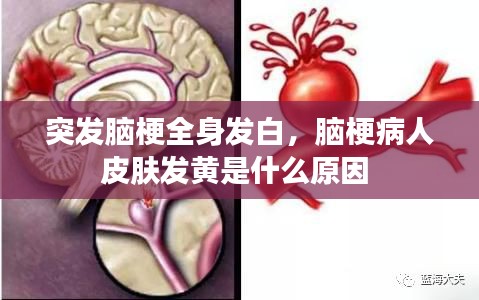 突发脑梗全身发白，脑梗病人皮肤发黄是什么原因 