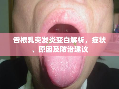 舌根乳突发炎变白解析，症状、原因及防治建议