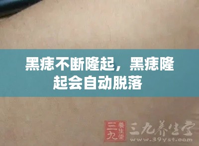 黑痣不断隆起，黑痣隆起会自动脱落 