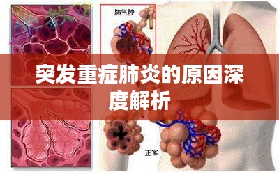 突发重症肺炎的原因深度解析