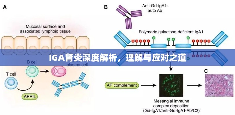 IGA肾炎深度解析，理解与应对之道